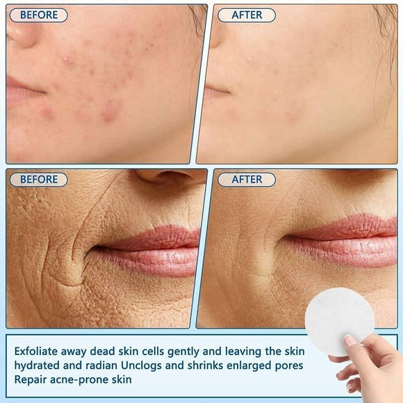 Acolye Glycolic Acid 20% Exfoliating Pads total of 55 - Picture 6 of 10